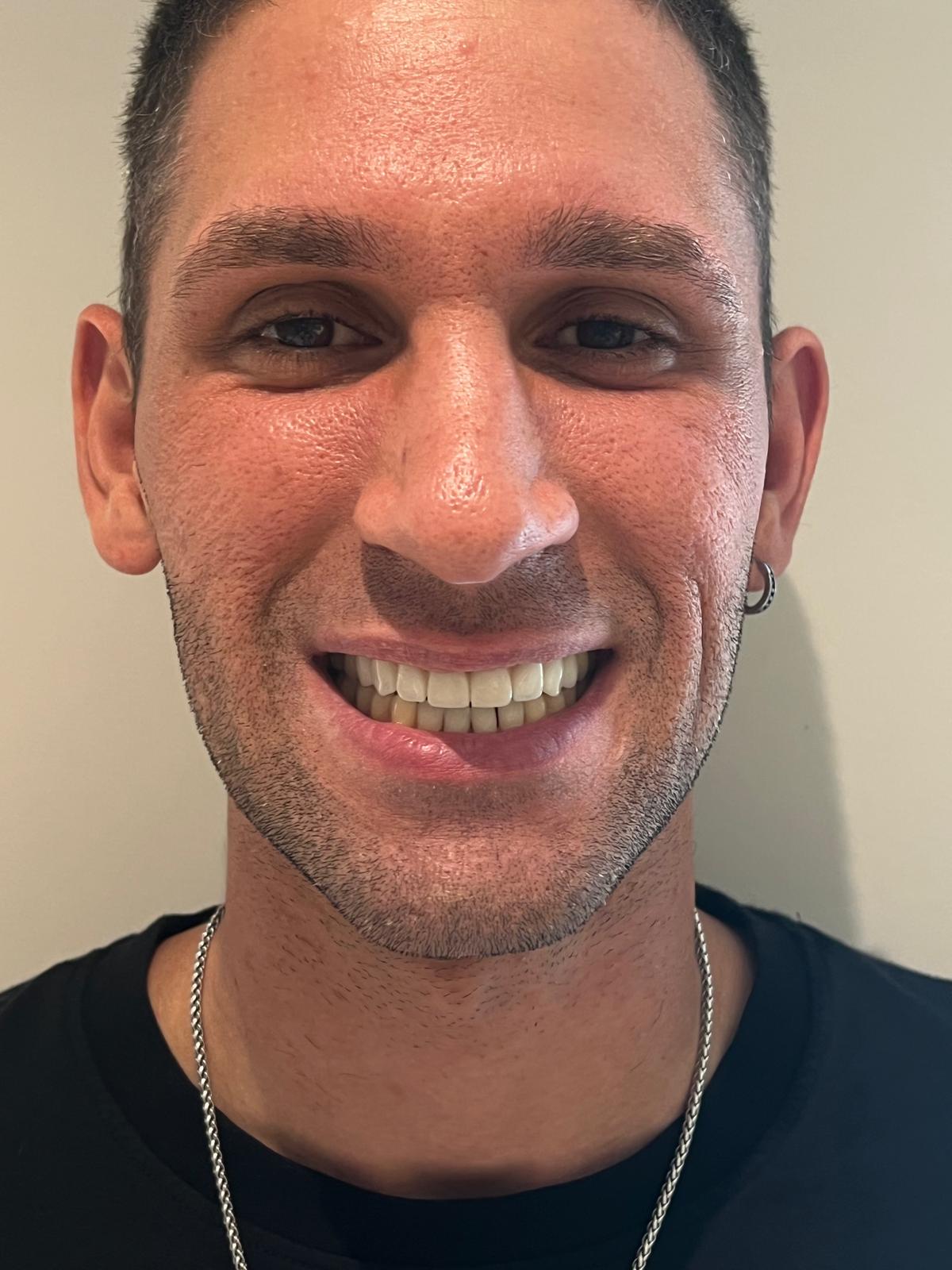 ECE Dental Patient Transformation